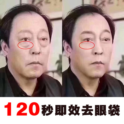 相学 眼袋 有黑眼圈的人面相学？是否容易命运坎坷？