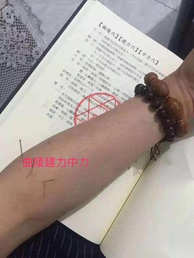 二十八星宿解神针套是什么意思？你知道吗？